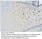 MAPK10 Antibody in Immunohistochemistry (IHC)