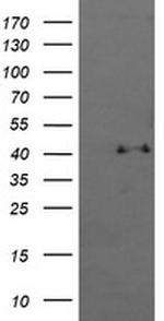 MAPK13 Antibody in Western Blot (WB)