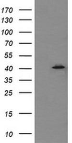 MAPK13 Antibody in Western Blot (WB)