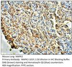 MAPK2 Antibody in Immunohistochemistry (IHC)