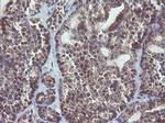 MAPK9 Antibody in Immunohistochemistry (Paraffin) (IHC (P))