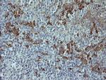 MAPK9 Antibody in Immunohistochemistry (Paraffin) (IHC (P))