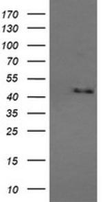 MAPK9 Antibody in Western Blot (WB)