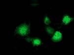 EB2 (MAPRE2) Antibody in Immunocytochemistry (ICC/IF)