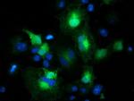 EB2 (MAPRE2) Antibody in Immunocytochemistry (ICC/IF)