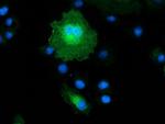 EB2 (MAPRE2) Antibody in Immunocytochemistry (ICC/IF)