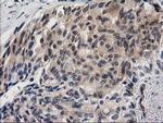 EB2 (MAPRE2) Antibody in Immunohistochemistry (Paraffin) (IHC (P))