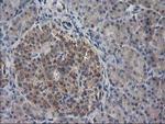 EB2 (MAPRE2) Antibody in Immunohistochemistry (Paraffin) (IHC (P))