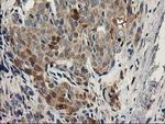 EB2 (MAPRE2) Antibody in Immunohistochemistry (Paraffin) (IHC (P))