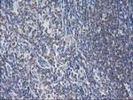 EB2 (MAPRE2) Antibody in Immunohistochemistry (Paraffin) (IHC (P))