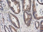 EB2 (MAPRE2) Antibody in Immunohistochemistry (Paraffin) (IHC (P))