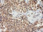 EB2 (MAPRE2) Antibody in Immunohistochemistry (Paraffin) (IHC (P))