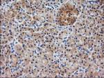 EB2 (MAPRE2) Antibody in Immunohistochemistry (Paraffin) (IHC (P))