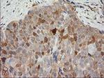 EB2 (MAPRE2) Antibody in Immunohistochemistry (Paraffin) (IHC (P))