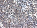 EB2 (MAPRE2) Antibody in Immunohistochemistry (Paraffin) (IHC (P))