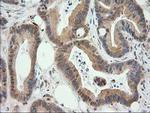 EB2 (MAPRE2) Antibody in Immunohistochemistry (Paraffin) (IHC (P))