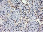 EB2 (MAPRE2) Antibody in Immunohistochemistry (Paraffin) (IHC (P))