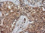 EB2 (MAPRE2) Antibody in Immunohistochemistry (Paraffin) (IHC (P))