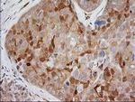 EB2 (MAPRE2) Antibody in Immunohistochemistry (Paraffin) (IHC (P))