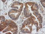 EB2 (MAPRE2) Antibody in Immunohistochemistry (Paraffin) (IHC (P))