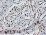 EB2 (MAPRE2) Antibody in Immunohistochemistry (Paraffin) (IHC (P))