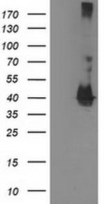 EB2 (MAPRE2) Antibody in Western Blot (WB)