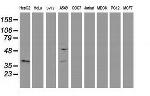 EB2 (MAPRE2) Antibody in Western Blot (WB)