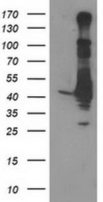 EB2 (MAPRE2) Antibody in Western Blot (WB)