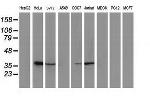 EB2 (MAPRE2) Antibody in Western Blot (WB)