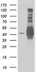 EB2 (MAPRE2) Antibody in Western Blot (WB)