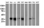 EB2 (MAPRE2) Antibody in Western Blot (WB)