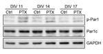 Phospho-MARK1/MARK2/MARK3 (Thr215, Thr208, Thr234) Antibody in Western Blot (WB)