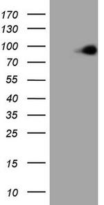 MARK3 Antibody in Western Blot (WB)