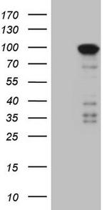 MARK3 Antibody in Western Blot (WB)