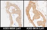 MARS Antibody in Immunohistochemistry (IHC)