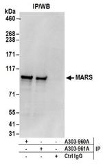 MARS Antibody in Western Blot (WB)