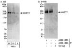 MAST2 Antibody in Western Blot (WB)