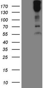 MAST2 Antibody in Western Blot (WB)