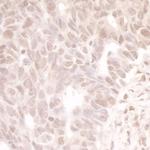 MASTL Antibody in Immunohistochemistry (IHC)