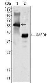 MATK Antibody in Western Blot (WB)