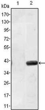 MATN1 Antibody in Western Blot (WB)