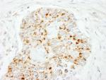 MAVS/VISA Antibody in Immunohistochemistry (IHC)