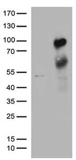 MBD1 Antibody in Western Blot (WB)