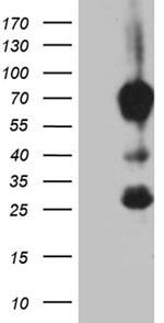 MBD1 Antibody in Western Blot (WB)