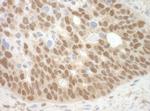 MBD3 Antibody in Immunohistochemistry (IHC)