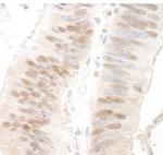 MBD3 Antibody in Immunohistochemistry (IHC)