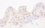 MBD4 Antibody in Immunohistochemistry (IHC)