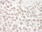 MBD4 Antibody in Immunohistochemistry (IHC)