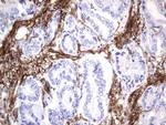 MCAM Antibody in Immunohistochemistry (Paraffin) (IHC (P))