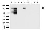 MCAM Antibody in Western Blot (WB)